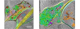 Electron Micros...