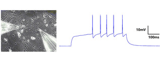 Electrophysiolo...